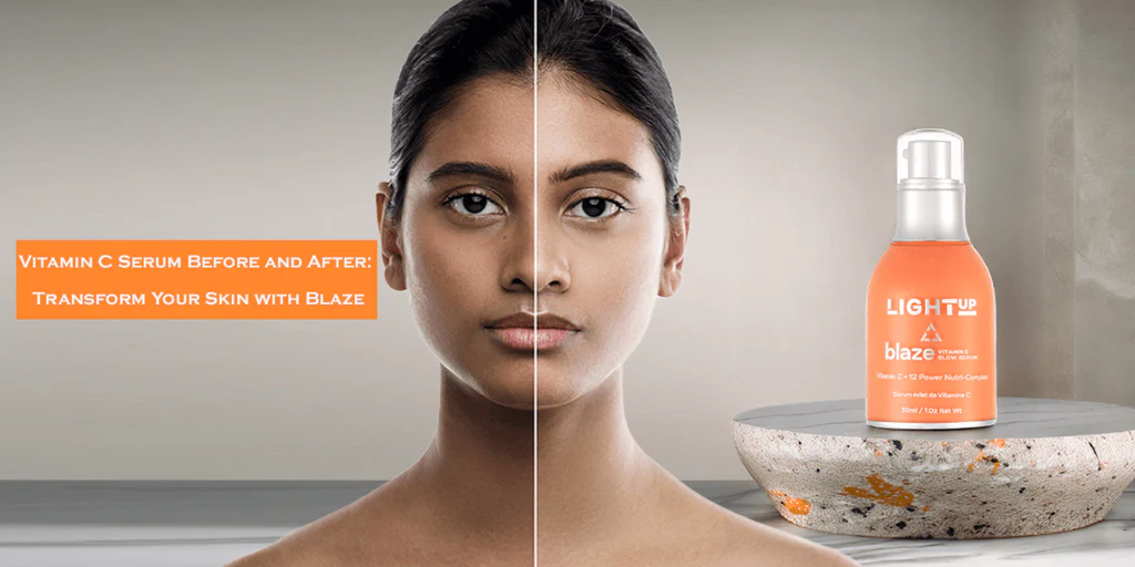 Vitamin C Serum Before and After: The Complete Guide
